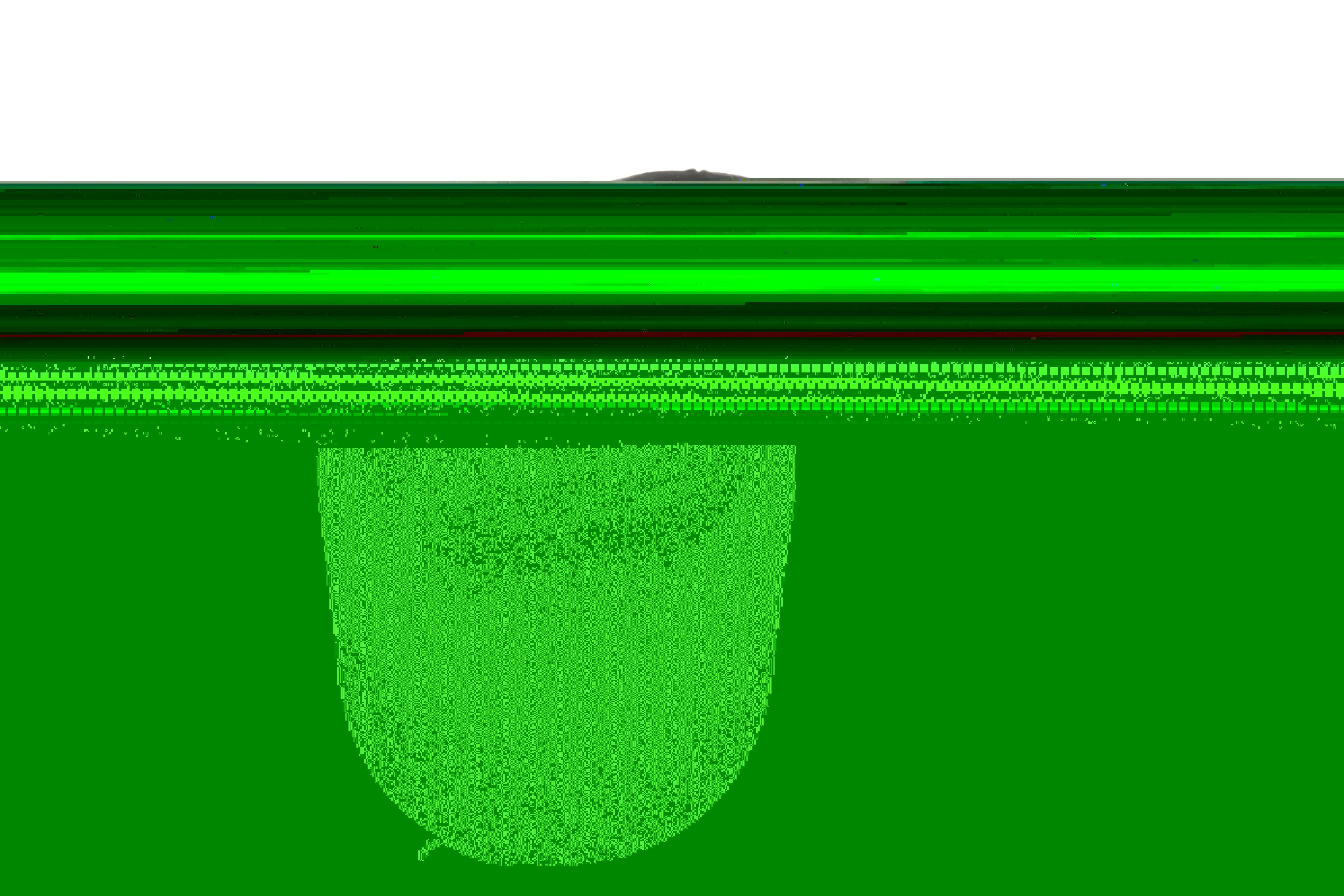 Сайлентблок важеля (переднього/знизу/спереду/всередині) BMW 5 (F10/F18) 08- B47/N20/N47/N55/N57/N63